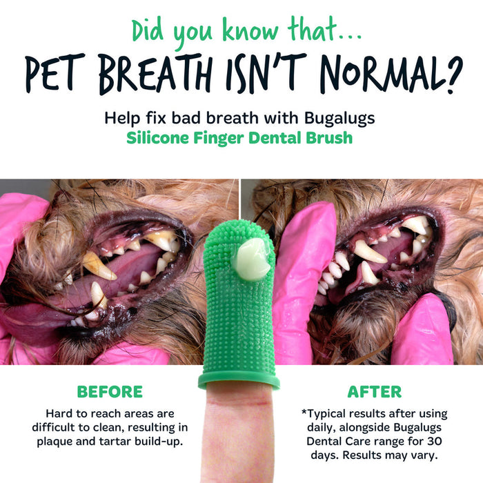 Finger Toothbrush Single